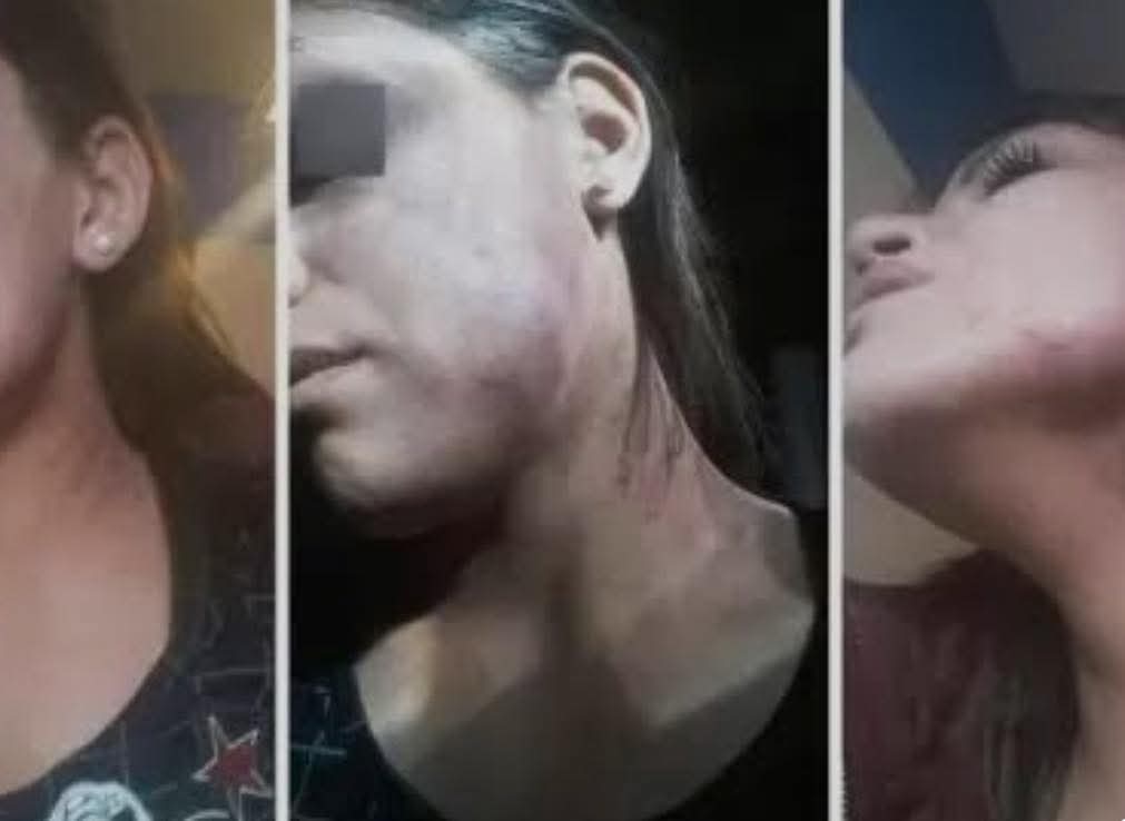 BRUTAL AGRESIÓN EN DEÁN FUNES: UNA MUJER DENUNCIA VIOLENCIA LABORAL EN UN RESTAURANTE